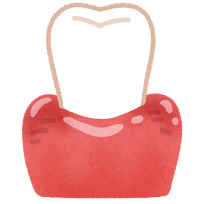 歯周病のイラスト2