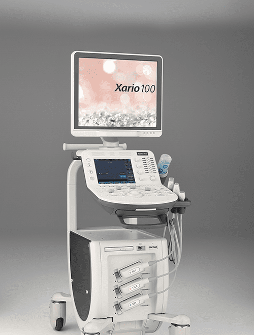 腹部超音波検査機械