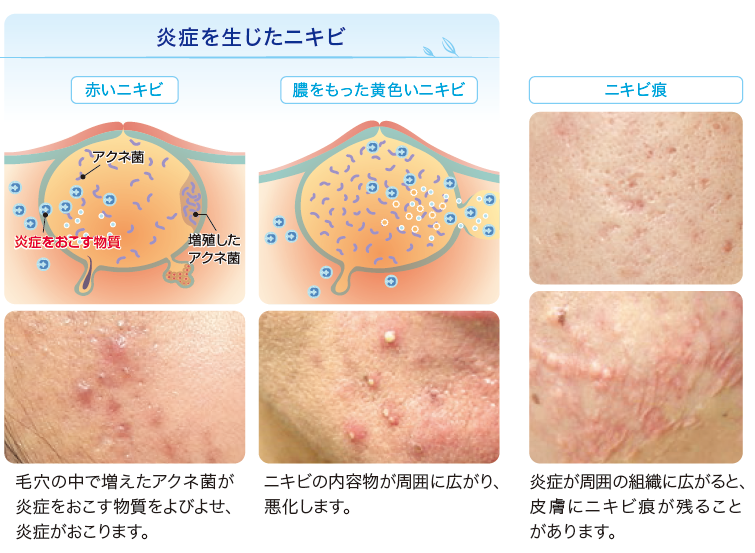 医師の診察を受ける時期