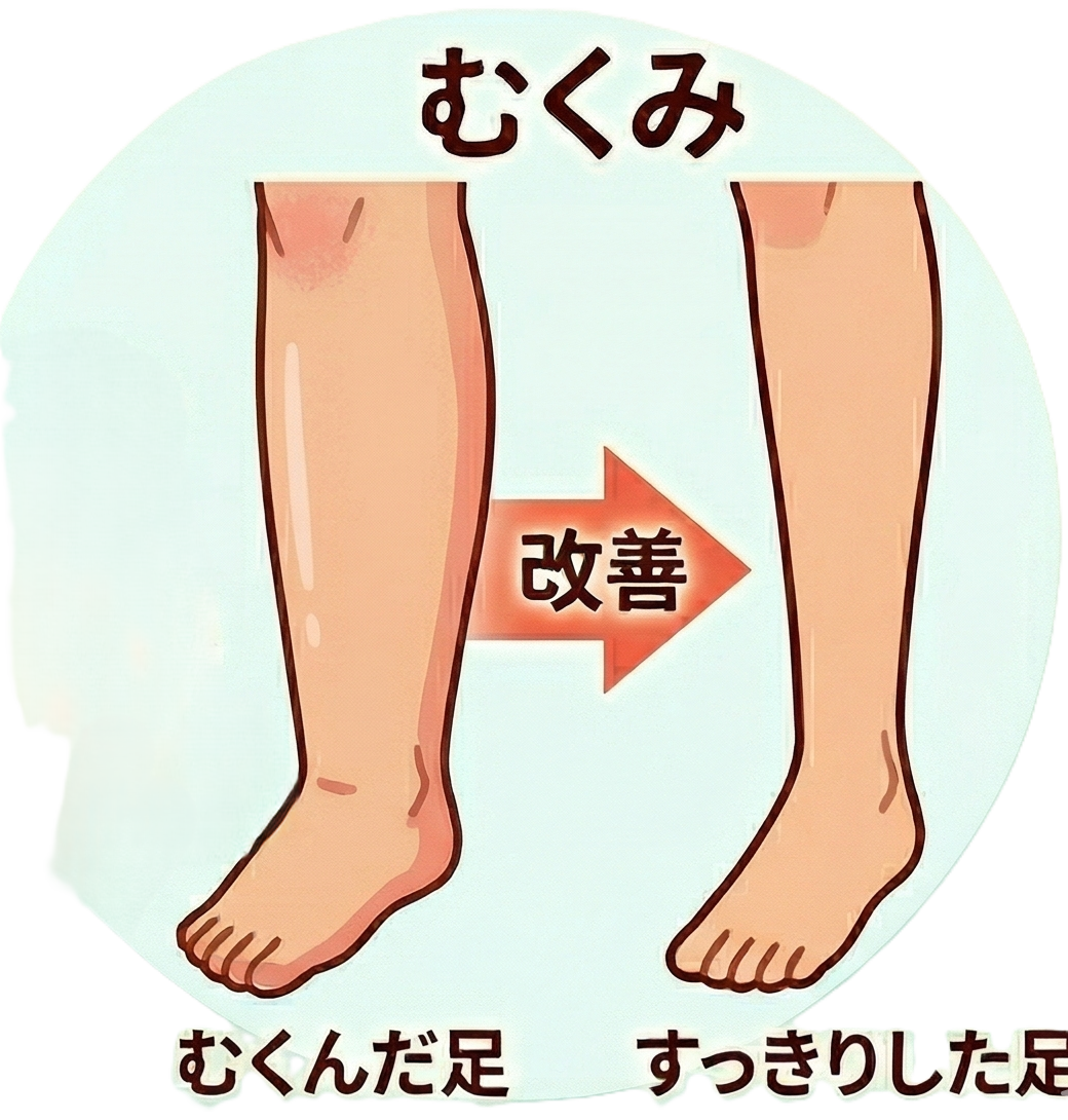 むくみ