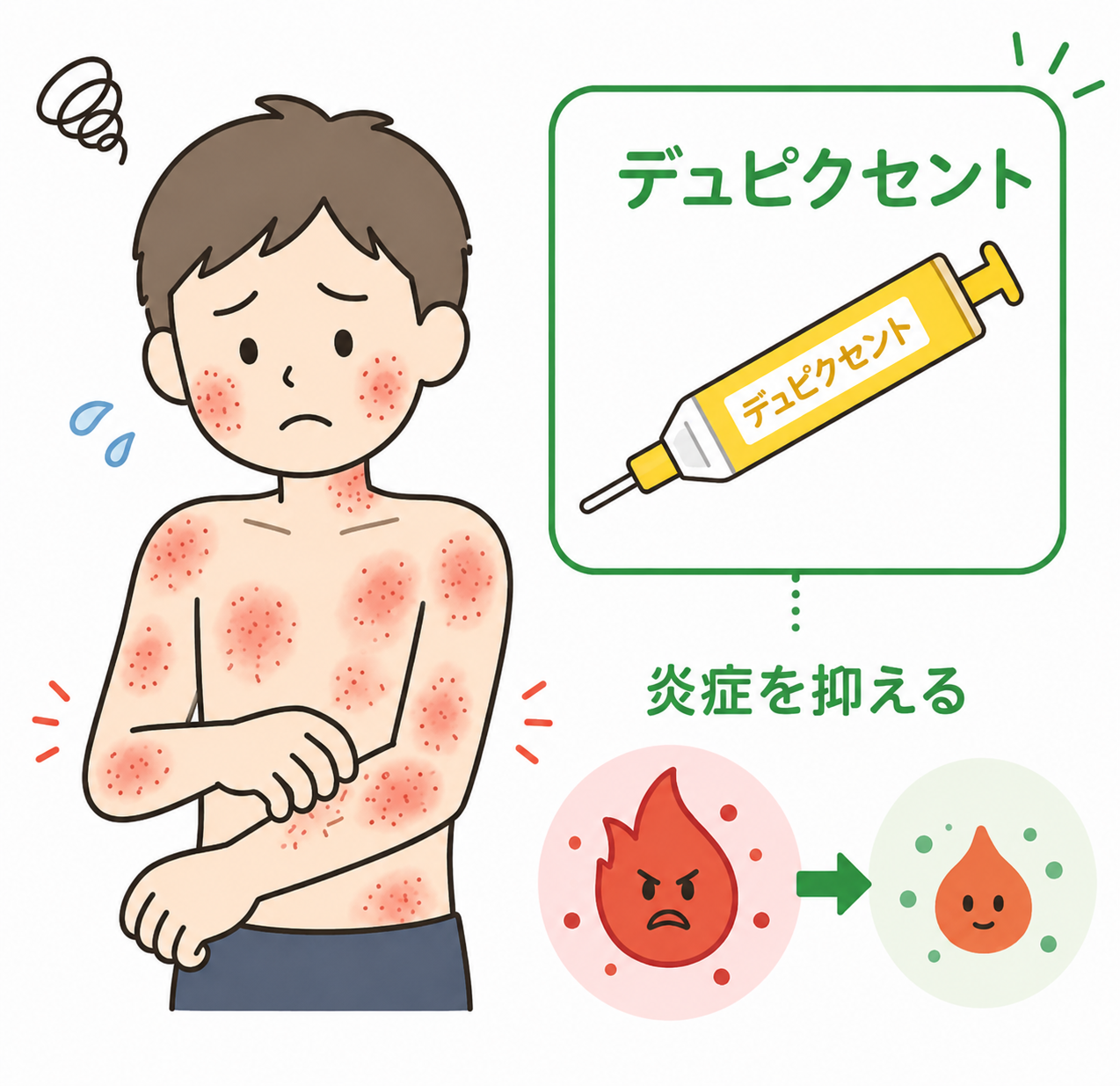 デュピクセントが皮膚の炎症を抑えるイメージ