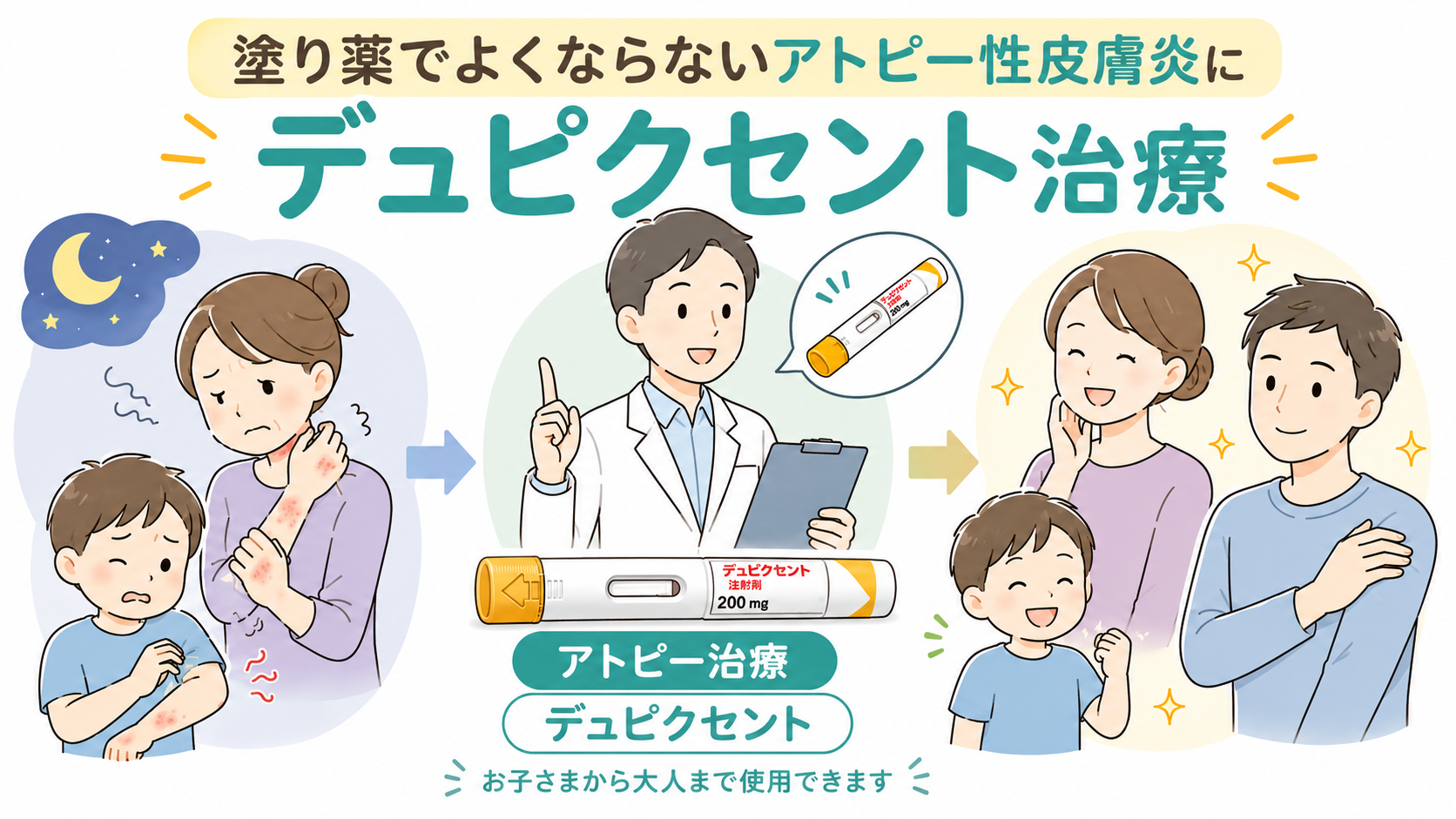 アトピー性皮膚炎で塗り薬を続けてもかゆみが改善しない方へデュピクセント治療を解説
