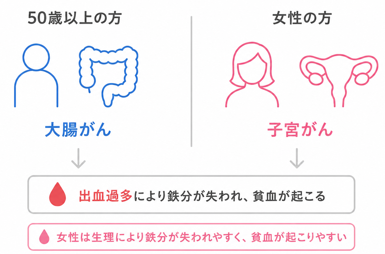 貧血の、見逃したくない原因は？